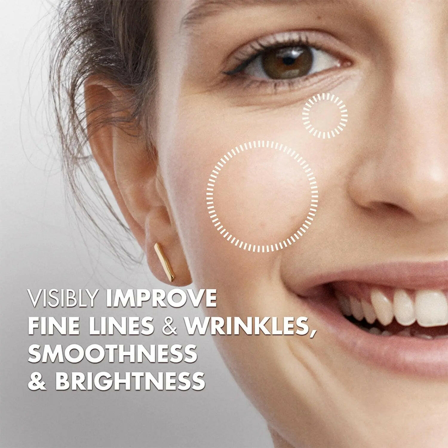 Ammuri Beauty Intense Skin Lightening Cream for Dark Spots-2